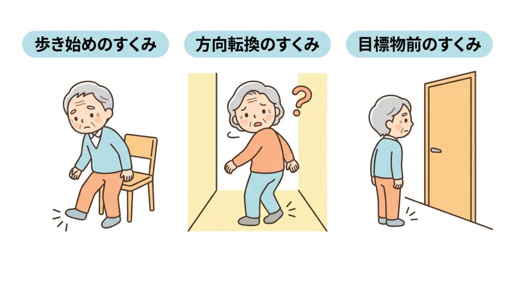 パーキンソン病のすくみ足3つのタイプ:歩き始めのすくみ、方向転換のすくみ、目標物前のすくみを図解したイラスト
