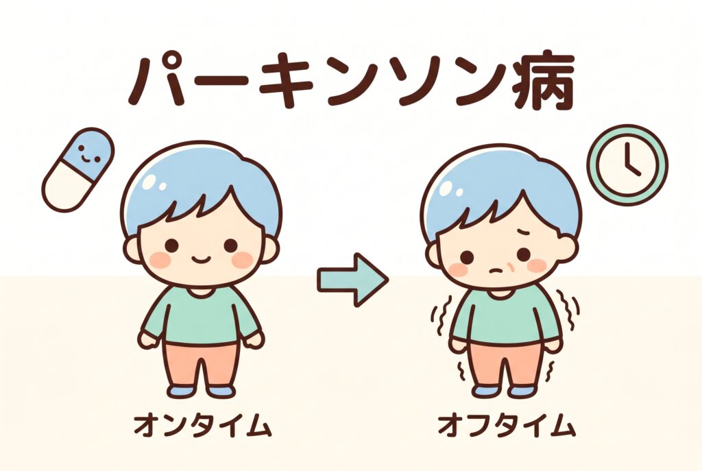 パーキンソン病の症状変動を表すイラスト。オンタイムとオフタイムの状態の違いを示している